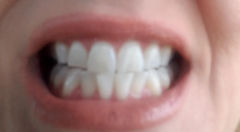 Teeth Whitening Specials Deals Clayton Raleigh NC